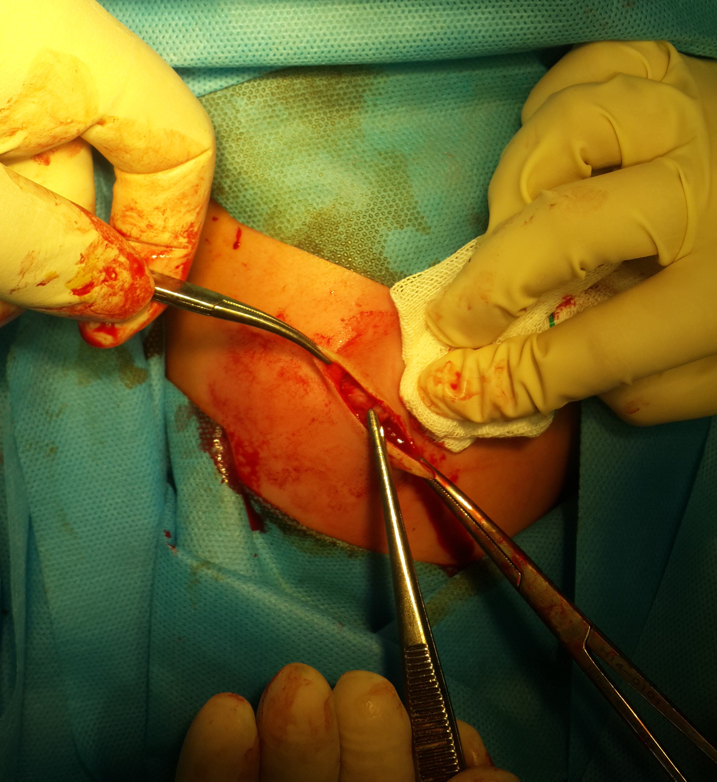 جراحی نوزاد02